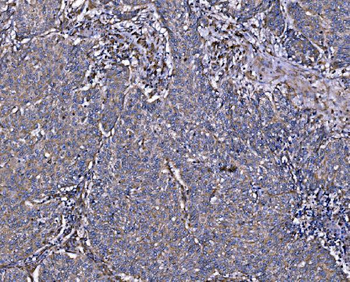 Integrin linked ILK Rabbit Polyclonal Antibody