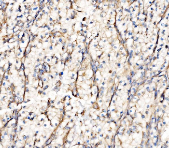 Integrin linked ILK Rabbit Polyclonal Antibody