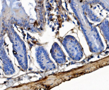 Integrin linked ILK Rabbit Polyclonal Antibody