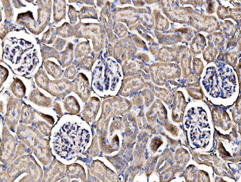 Integrin linked ILK Rabbit Polyclonal Antibody