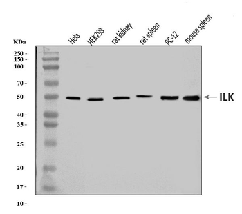 Integrin linked ILK Rabbit Polyclonal Antibody