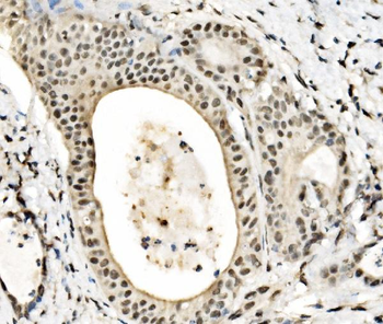 JUNB Rabbit Polyclonal Antibody