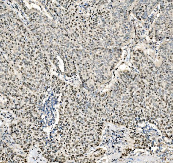 JUNB Rabbit Polyclonal Antibody