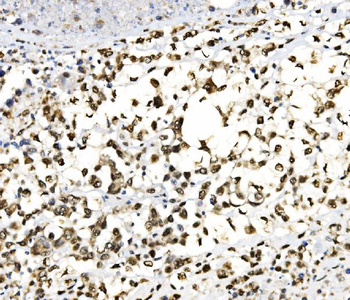 JUNB Rabbit Polyclonal Antibody