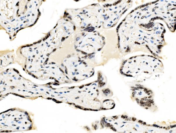 JUNB Rabbit Polyclonal Antibody