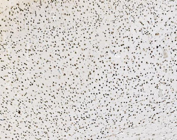 JUNB Rabbit Polyclonal Antibody