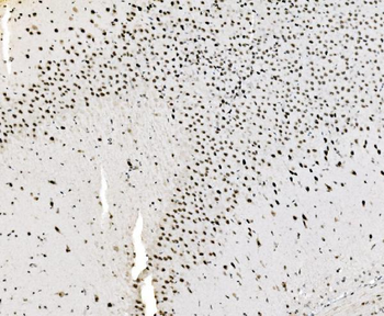 JUNB Rabbit Polyclonal Antibody