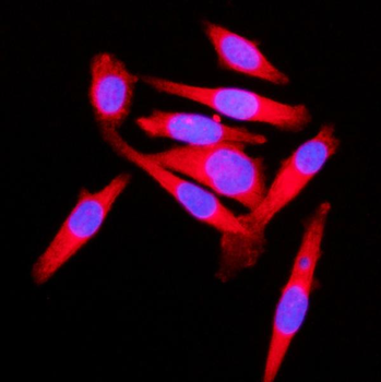 KLC1 Rabbit Polyclonal Antibody