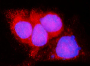 LACTB Rabbit Polyclonal Antibody