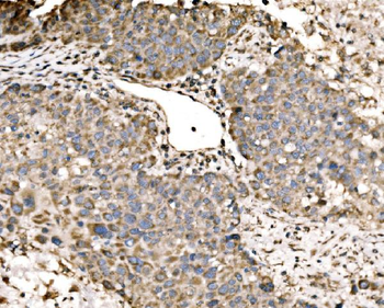 LACTB Rabbit Polyclonal Antibody