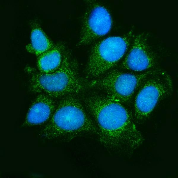 ASK1/MAP3K5 Rabbit Polyclonal Antibody
