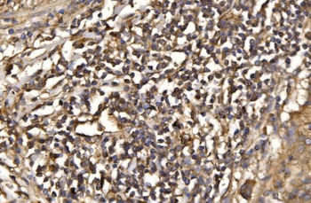 ASK1/MAP3K5 Rabbit Polyclonal Antibody