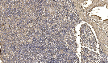 ASK1/MAP3K5 Rabbit Polyclonal Antibody