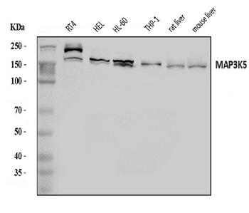 ASK1/MAP3K5 Rabbit Polyclonal Antibody