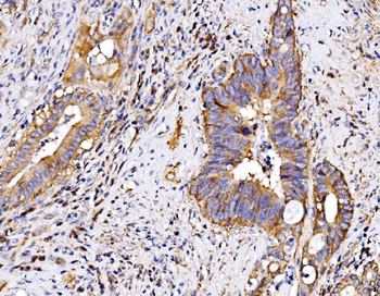 P2X7/P2RX7 Rabbit Polyclonal Antibody