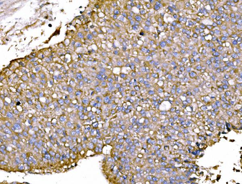 P2X7/P2RX7 Rabbit Polyclonal Antibody
