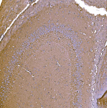 P2X7/P2RX7 Rabbit Polyclonal Antibody