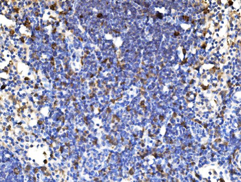 PAK1 Rabbit Polyclonal Antibody