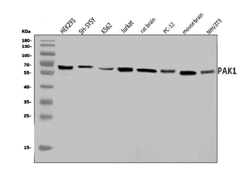 PAK1 Rabbit Polyclonal Antibody