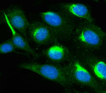 PAK1 Rabbit Polyclonal Antibody