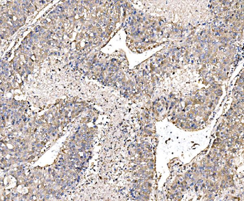 PAK1 Rabbit Polyclonal Antibody