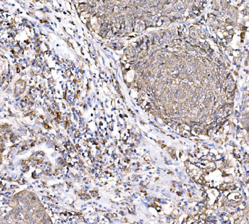 PAK1 Rabbit Polyclonal Antibody