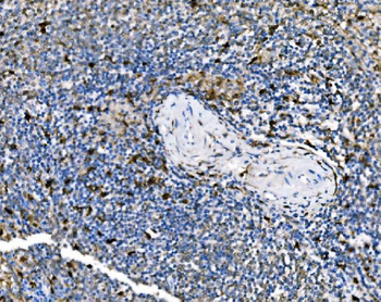 PAK1 Rabbit Polyclonal Antibody