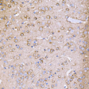PAK1 Rabbit Polyclonal Antibody
