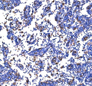 PAK1 Rabbit Polyclonal Antibody