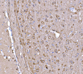 PAK1 Rabbit Polyclonal Antibody
