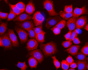 RPL10 Rabbit Polyclonal Antibody