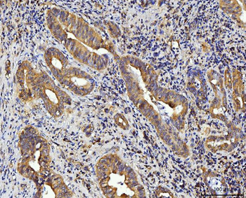 RPL10 Rabbit Polyclonal Antibody