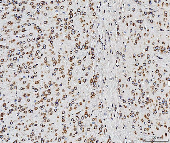 RPL10 Rabbit Polyclonal Antibody