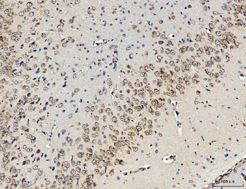 RPL10 Rabbit Polyclonal Antibody