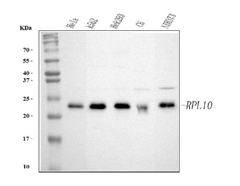 RPL10 Rabbit Polyclonal Antibody