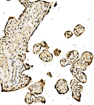 SPHK1 Rabbit Polyclonal Antibody