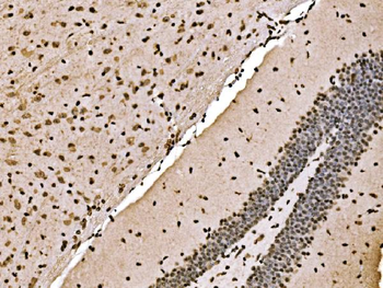 SPHK1 Rabbit Polyclonal Antibody