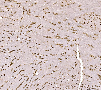 SPHK1 Rabbit Polyclonal Antibody