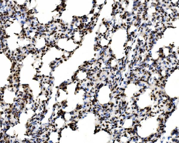 SPHK1 Rabbit Polyclonal Antibody