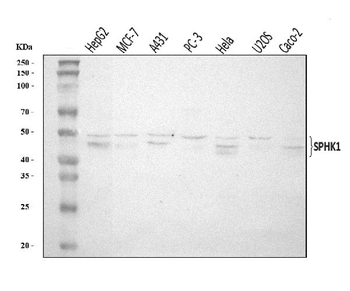 SPHK1 Rabbit Polyclonal Antibody