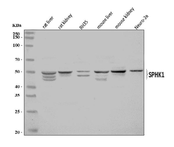SPHK1 Rabbit Polyclonal Antibody