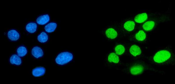 SPHK1 Rabbit Polyclonal Antibody