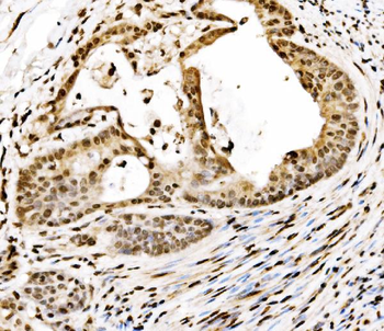 SPHK1 Rabbit Polyclonal Antibody