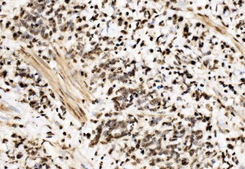 SPHK1 Rabbit Polyclonal Antibody