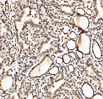 SPHK1 Rabbit Polyclonal Antibody
