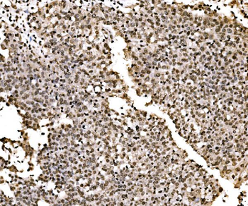 SPHK1 Rabbit Polyclonal Antibody