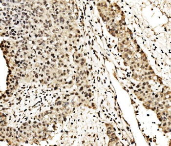 SPHK1 Rabbit Polyclonal Antibody