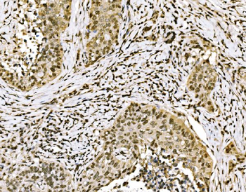 SPHK1 Rabbit Polyclonal Antibody