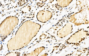 SPHK1 Rabbit Polyclonal Antibody