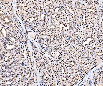 SSB Rabbit Polyclonal Antibody